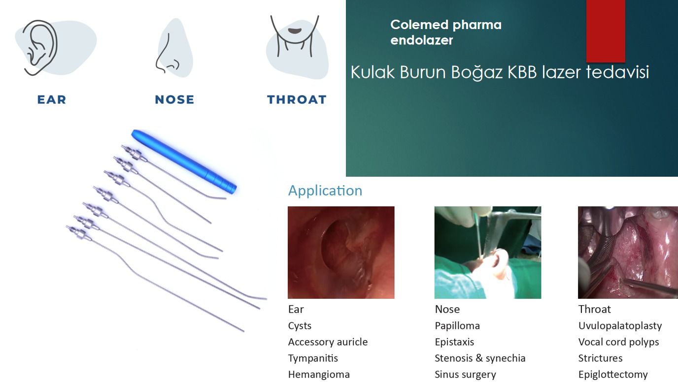 Kulak Burun Boğaz KBB lazer tedavisi başlık